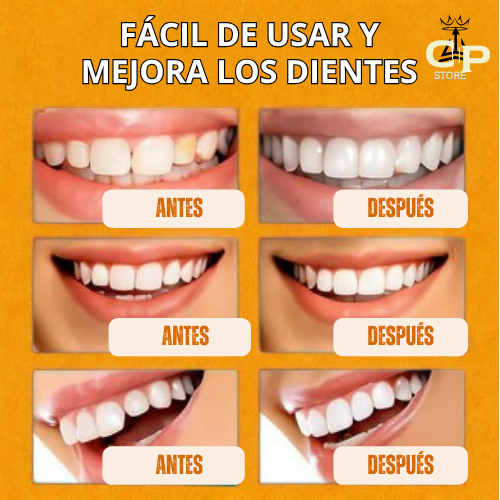 ¡OFERTA DE HOY!⌛CARILLAS DENTALES ADAPTABLES 2X1 +ENVIO GRATIS🏡🚚