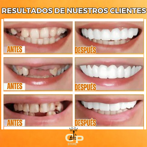 ¡OFERTA DE HOY!⌛CARILLAS DENTALES ADAPTABLES 2X1 +ENVIO GRATIS🏡🚚