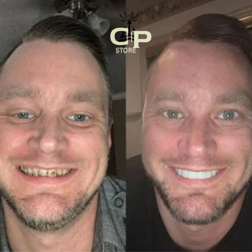 ¡OFERTA DE HOY!⌛CARILLAS DENTALES ADAPTABLES 2X1 +ENVIO GRATIS🏡🚚