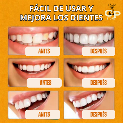 ¡OFERTA DE HOY!⌛CARILLAS DENTALES ADAPTABLES 2X1 +ENVIO GRATIS🏡🚚
