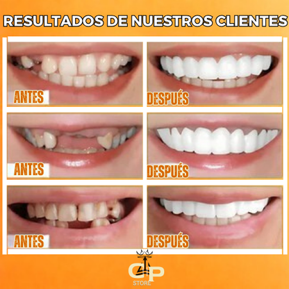¡OFERTA DE HOY!⌛CARILLAS DENTALES ADAPTABLES 2X1 +ENVIO GRATIS🏡🚚